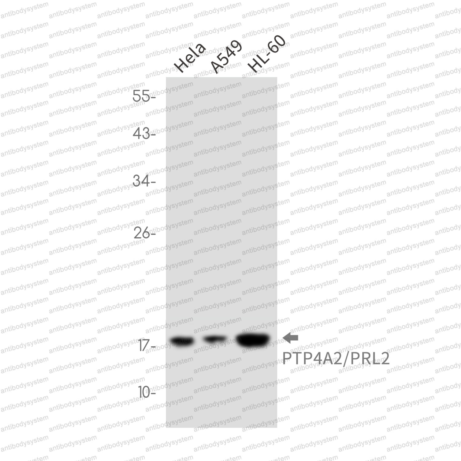 Anti-PTP4A2 Antibody (R2D62)