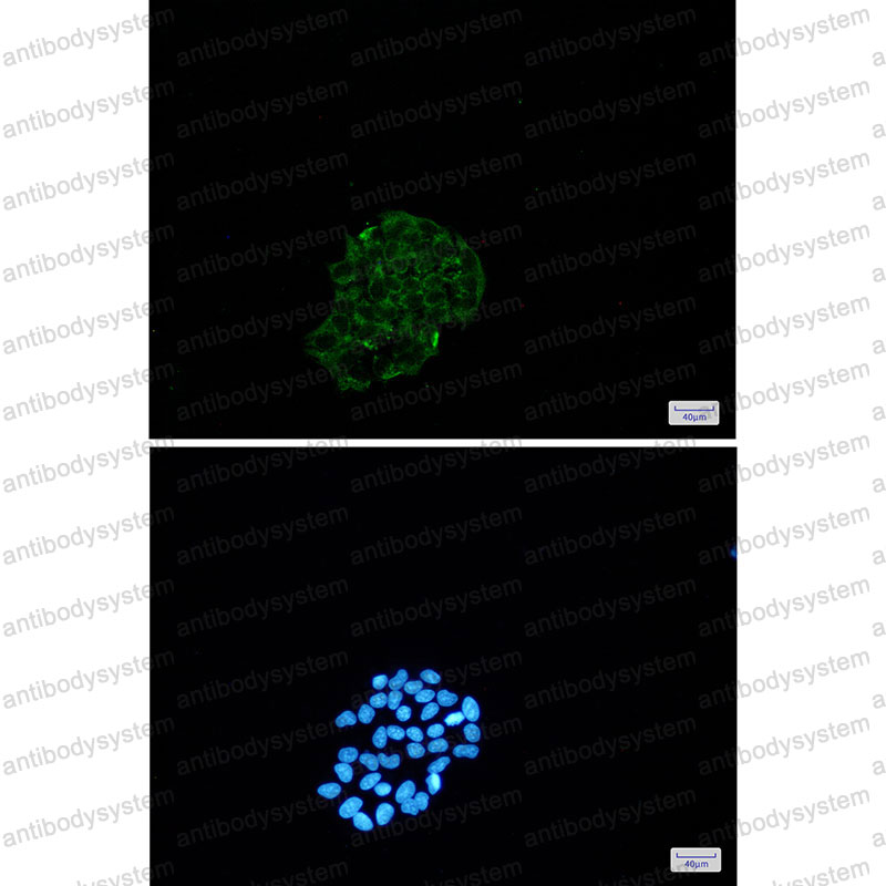 Anti-BNIP3 Antibody (R2D64)