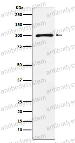 Anti-GRIK2 Antibody (R2D65)