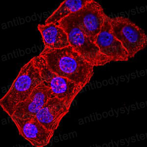 Anti-GRIK3 Antibody (R3S03)