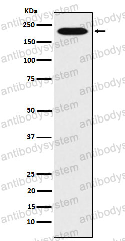 Anti-ARHGAP5 Antibody (R2D66)