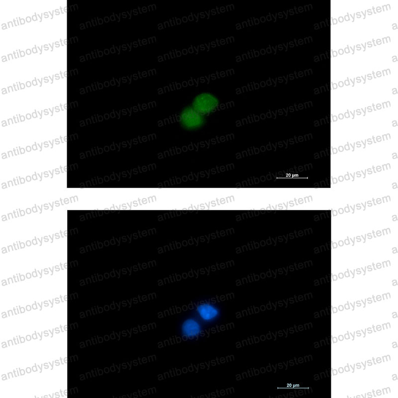 Anti-STK4 Antibody (R2D69)