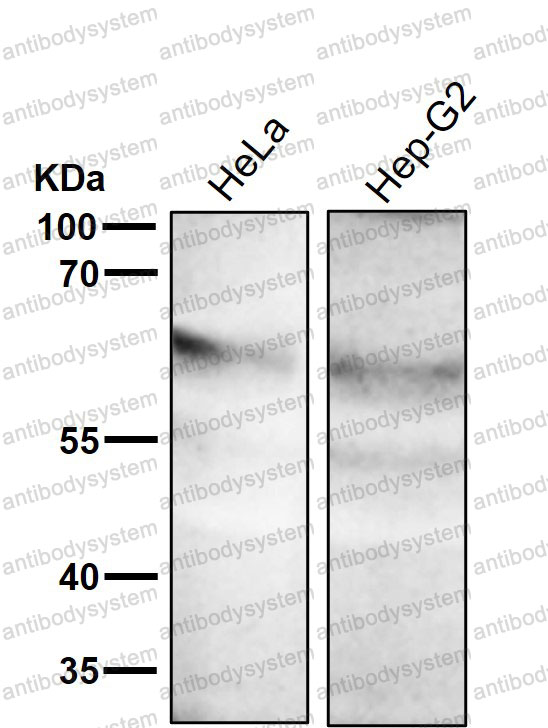 Anti-Phospho-MST1/MST2 (T183 + T180) Antibody (R2D68)