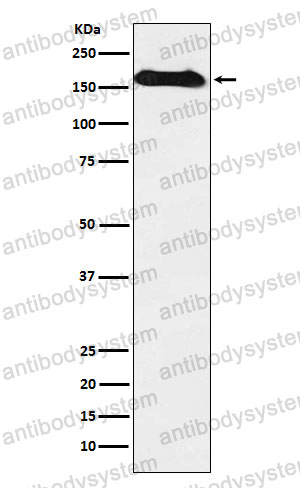 Anti-NAIP Antibody (R2D71)
