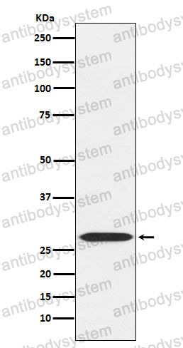 Anti-MRPL28 Antibody (R2D72)