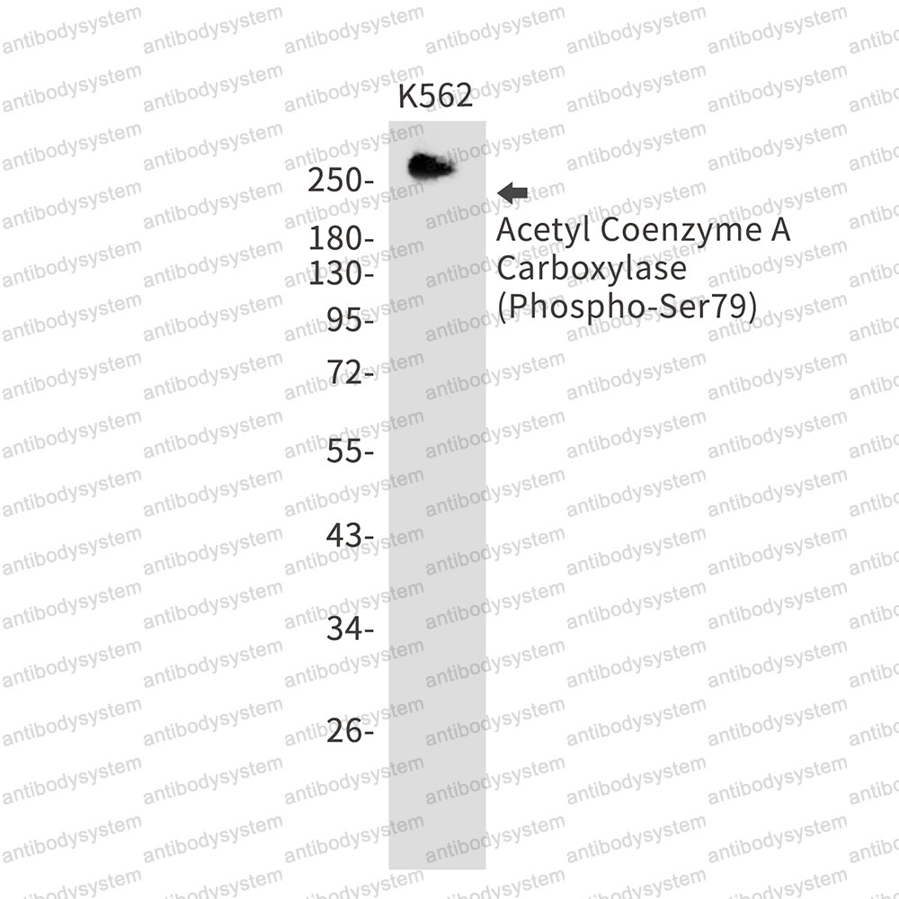 Anti-Phospho-ACACA (Ser79) Antibody (R2D74)