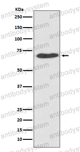 Anti-PDIA2 Antibody (R2D75)