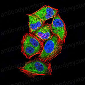 Anti-LpPLA2/PLA2G7/PAF-AH Antibody (R3S06)
