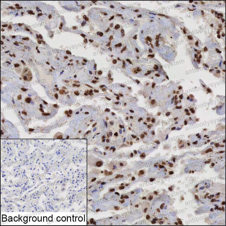 Anti-ZBTB17 Antibody (R3S08)