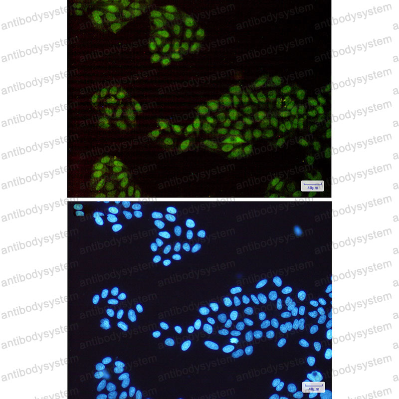 Anti-CHAF1A/p150 Antibody (R2D79)