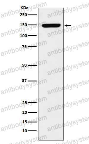 Anti-CHAF1A Antibody (R2D78)