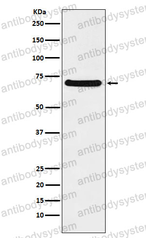 Anti-CHAF1B Antibody (R2D80)