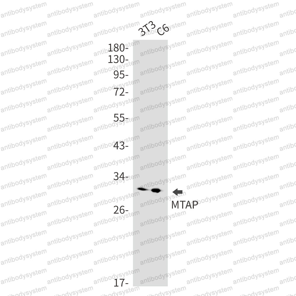 Anti-MTAP Antibody (R2D84)
