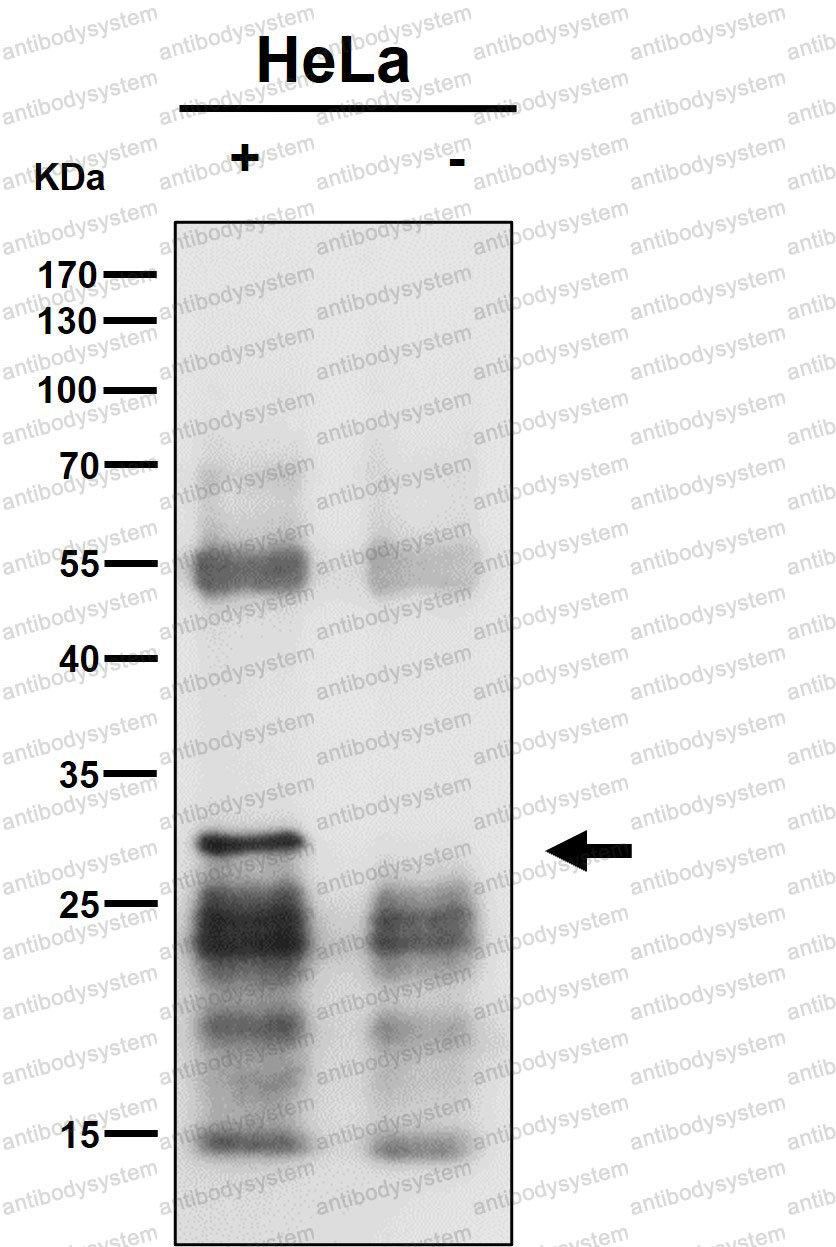 Anti-MTAP Antibody (R2D82)