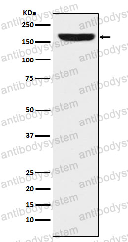Anti-REST Antibody (R2D85)