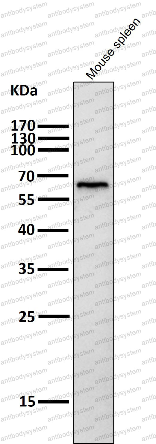 Anti-Phospho-PRKAA1/AMPK alpha 1 (Thr172) Antibody (R2D86)