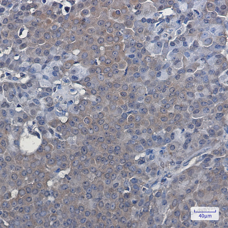 Anti-NR1H3 Antibody (R2D89)