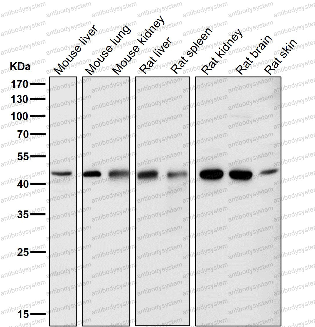 Anti-NR1H3 Antibody (R2D88)