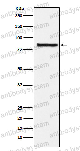 Anti-EIF2B5 Antibody (R2D90)