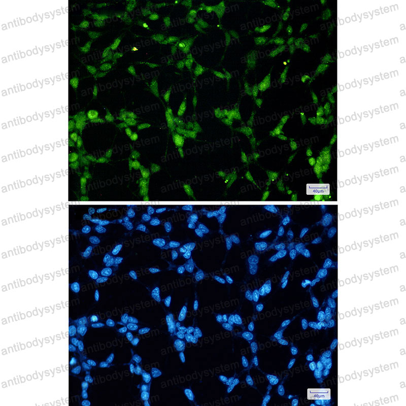 Anti-TARDBP/TDP43 Antibody (R2D91)