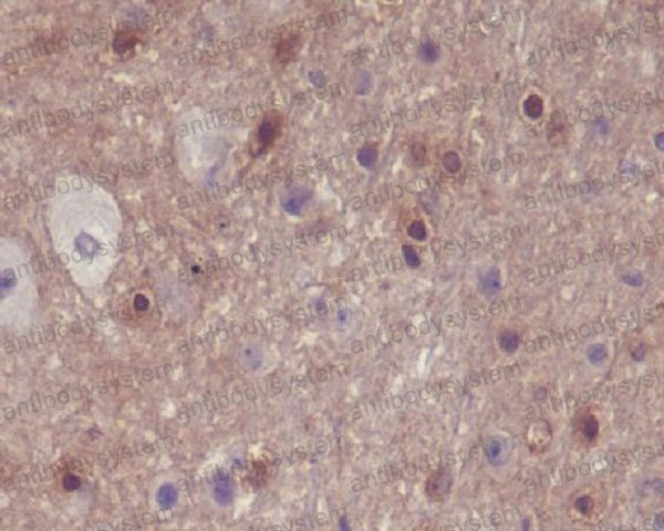 Anti-Phospho-PAK1/2/3 (S144 + S141 + S139) Antibody (R1B37)