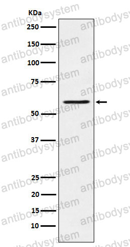 Anti-PAK1 Antibody (R2D92)