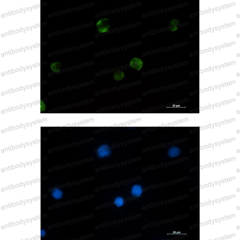 Anti-PAK1 Antibody (R2D93)