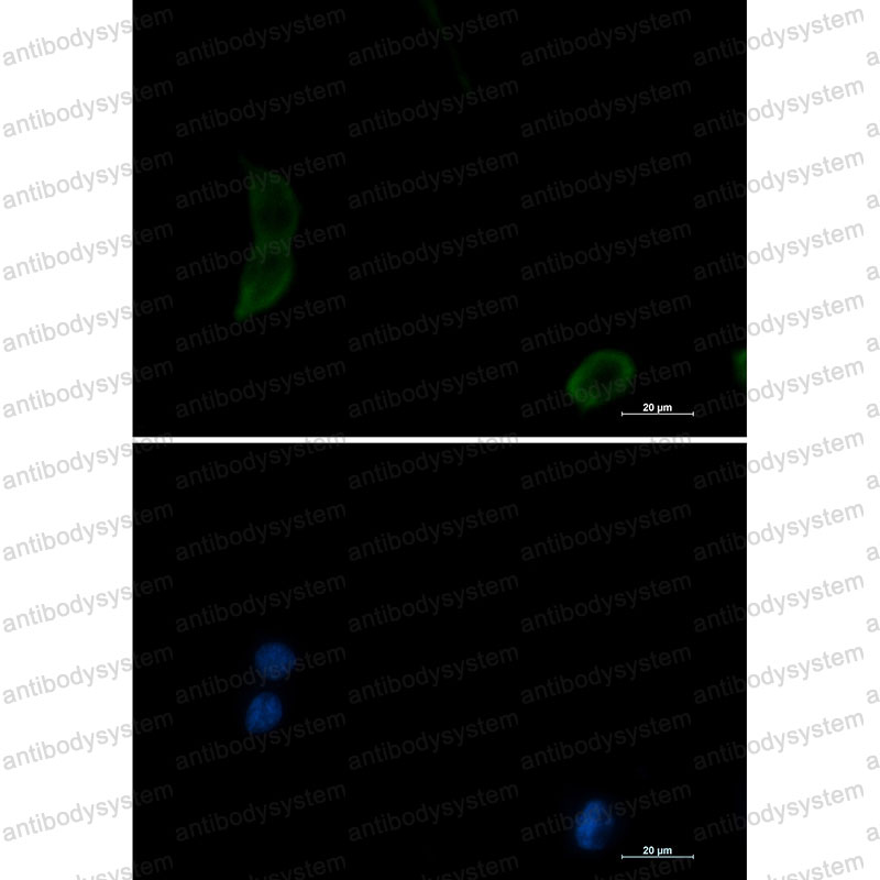 Anti-PAK1 Antibody (R2D94)