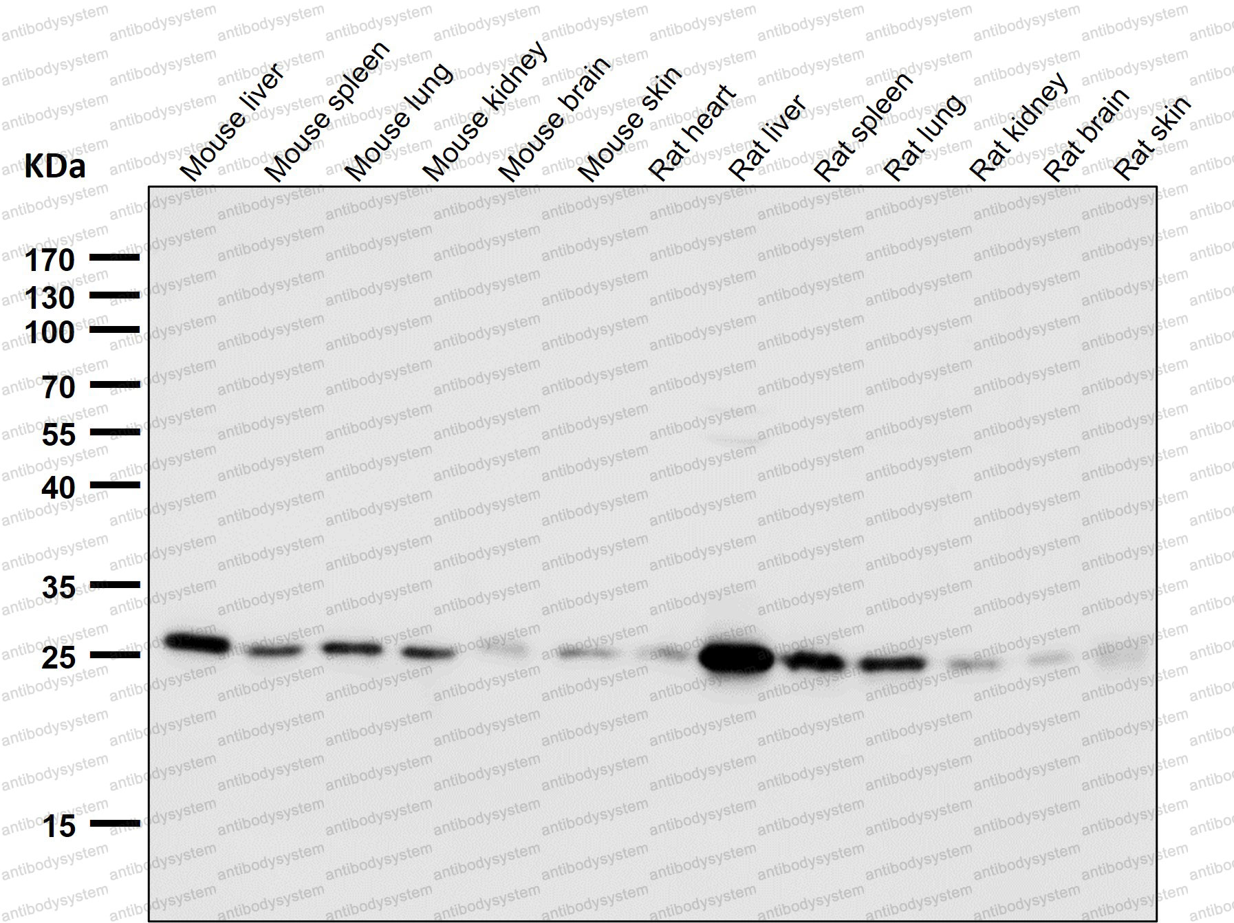Anti-PRDX4 Antibody (R2D98)