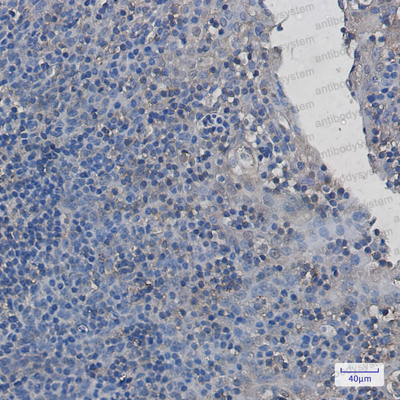 Anti-PAK2 Antibody (R2E02)