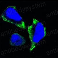 Anti-PAK2 Antibody (R3S18)