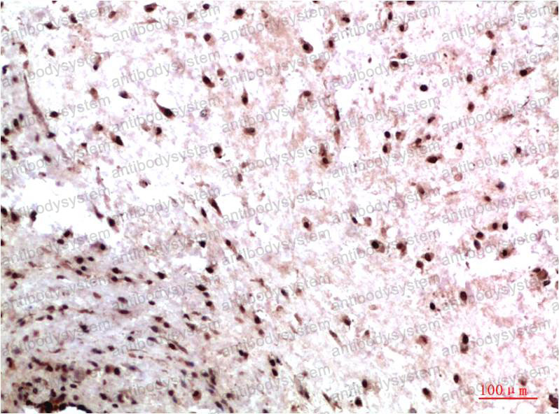 Anti-CBX3 Antibody (R3S20)