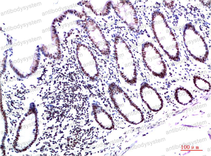 Anti-CBX3 Antibody (R3S21)