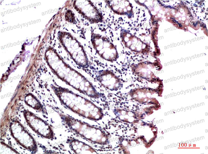 Anti-CBX3 Antibody (R3S22)