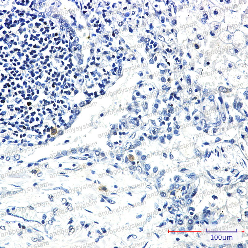Anti-STK3 Antibody (R2E06)