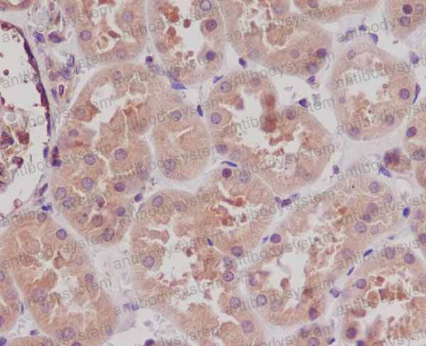 Anti-STK3 Antibody (R2E05)