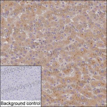 Anti-MAP3K1 Antibody (R3S25)