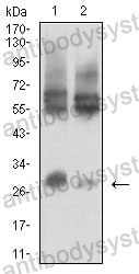 Anti-CD215/IL15RA Antibody (R3S27)