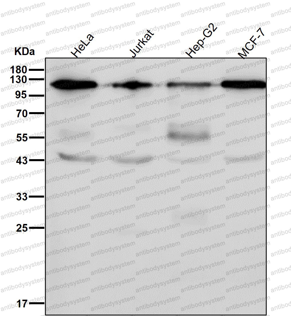Anti-TRIM28/KAP1 Antibody (R1A78)