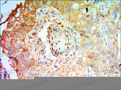 Anti-PTK7/CCK-4 Antibody (R3S30)