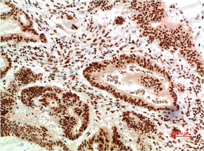 Anti-ATM Antibody (R3S33)