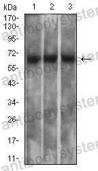 Anti-MSLN/Mesothelin Antibody (R3S44)