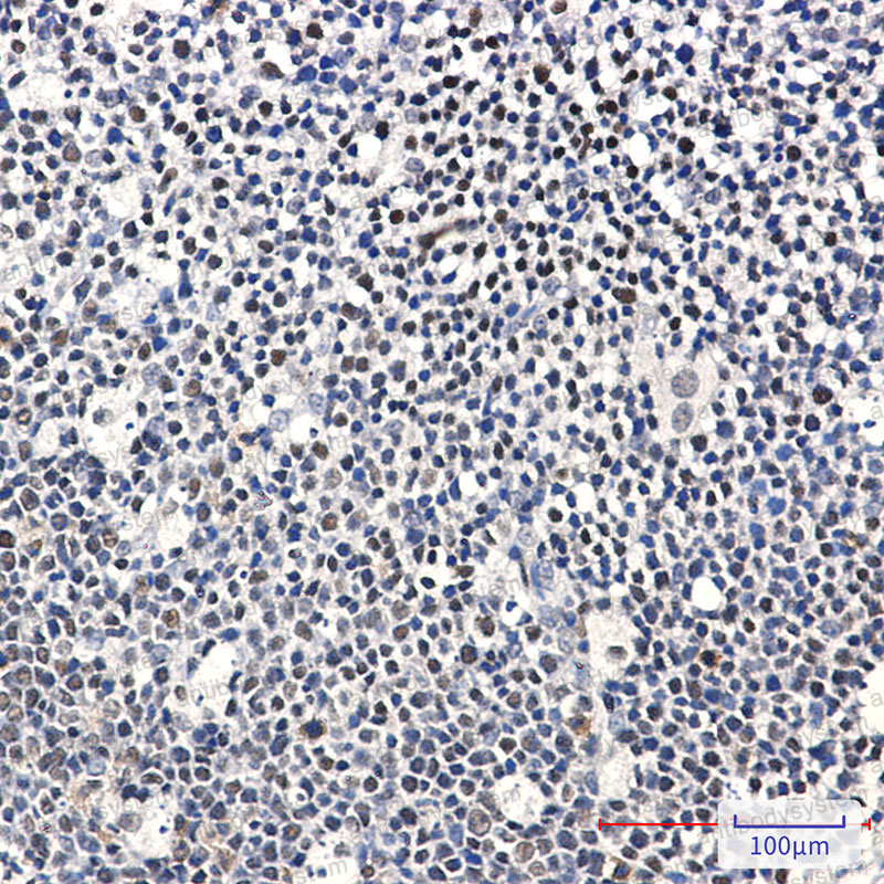 Anti-IKZF1 Antibody (R2E31)