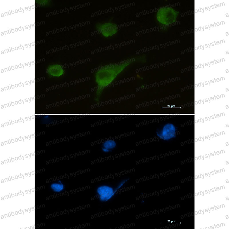 Anti-SNTA1 Antibody (R2E33)