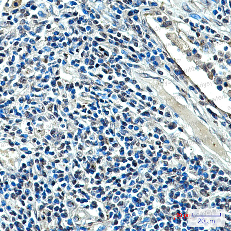 Anti-XRCC4 Antibody (R3S47)