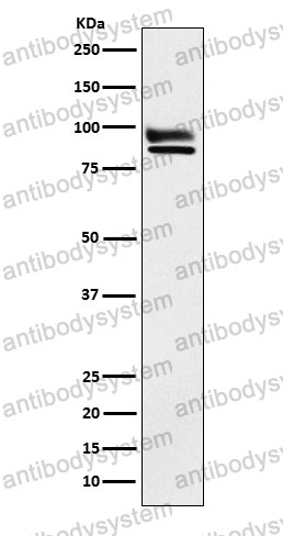 Anti-OS9 Antibody (R2E34)