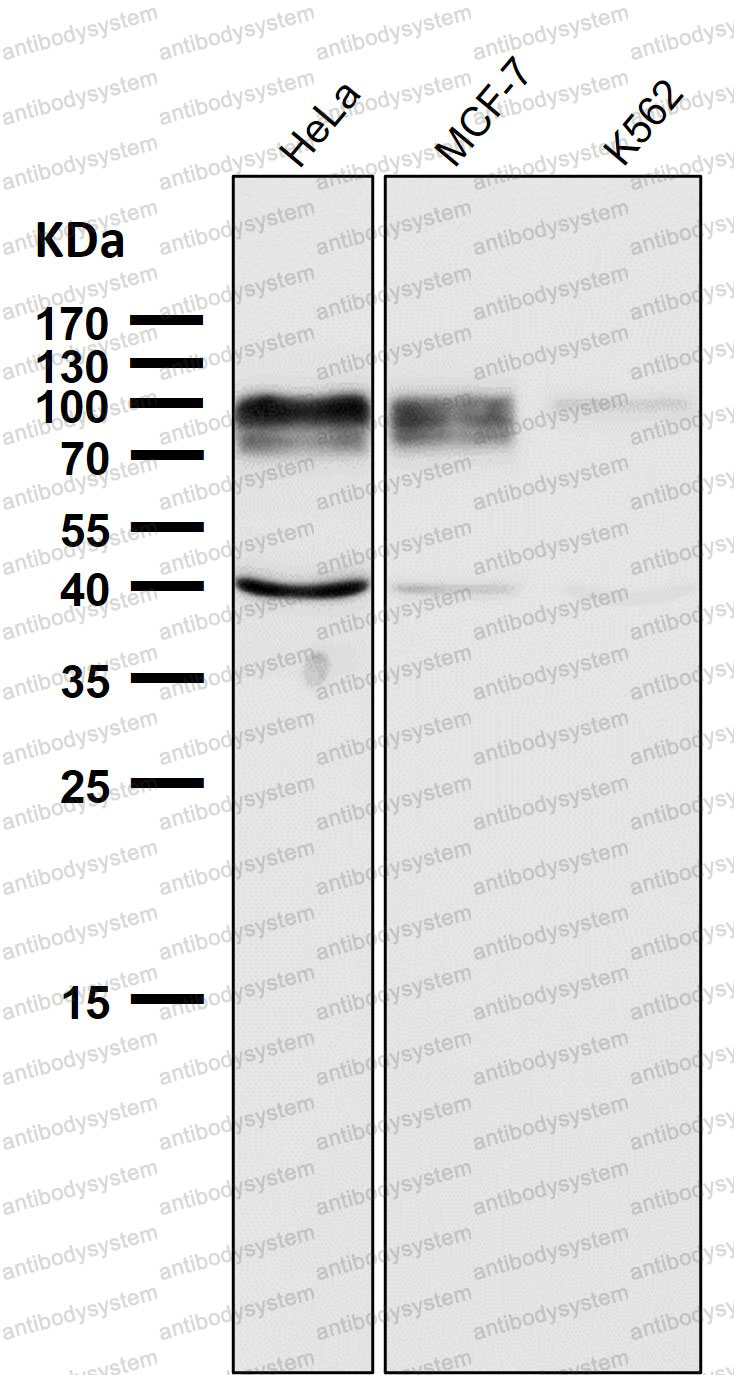 Anti-ADAM15/MDC15 Antibody (R2E35)