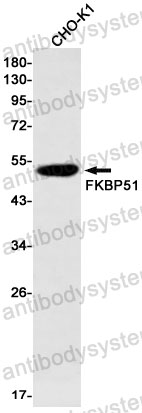 Anti-FKBP5 Antibody (R2E37)