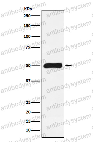 Anti-FKBP5 Antibody (R2E36)
