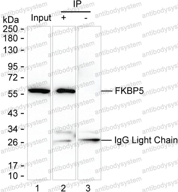 Anti-FKBP5 Antibody (R3S51)